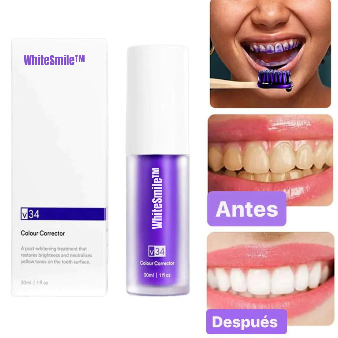 WhiteSmile™ - Blanqueador Dental v34 (OFERTA 2x1 ¡SOLO HOY!)